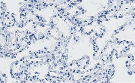 Anti-SFTPC Antibody, clone 3F18 ZooMAb® Rabbit Monoclonal recombinant, expressed in HEK 293 cells