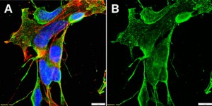 Anti-SCN10A Antibody, clone 1J13 ZooMAb® Rabbit Monoclonal recombinant, expressed in HEK 293 cells