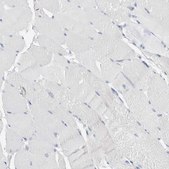 Anti-CASP6 antibody produced in rabbit Prestige Antibodies® Powered by Atlas Antibodies, affinity isolated antibody, buffered aqueous glycerol solution