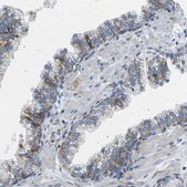 Anti-TMEFF2 antibody produced in rabbit Prestige Antibodies® Powered by Atlas Antibodies, affinity isolated antibody, buffered aqueous glycerol solution