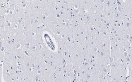 Anti-Histone H2A.X Antibody, clone 1C22 ZooMAb® Rabbit Monoclonal recombinant, expressed in HEK 293 cells