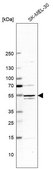 Anti-MAP2K5 antibody produced in rabbit Prestige Antibodies® Powered by Atlas Antibodies, affinity isolated antibody, buffered aqueous glycerol solution, ab2