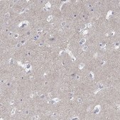 Anti-GRIA3 antibody produced in rabbit Prestige Antibodies® Powered by Atlas Antibodies, affinity isolated antibody, buffered aqueous glycerol solution