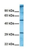 抗 SLC1A5 IgG fraction of antiserum
