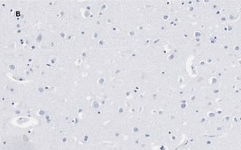Anti-Calretinin Antibody, clone 3K22, ZooMAb® Rabbit Monoclonal recombinant, expressed in HEK 293 cells