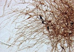 抗-酪氨酸羟化酶抗体，克隆2/40/15 clone 2/40/15, Chemicon®, from mouse