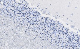 Anti-MAG Antibody, clone 1I6 ZooMAb® Rabbit Monoclonal recombinant, expressed in HEK 293 cells