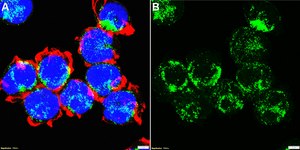 Anti-Interleukin-21 Antibody, clone 2B13 ZooMAb® Rabbit Monoclonal recombinant, expressed in HEK 293 cells