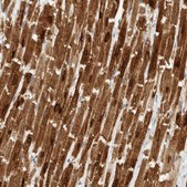 Anti-PLN antibody produced in rabbit Prestige Antibodies® Powered by Atlas Antibodies, affinity isolated antibody, buffered aqueous glycerol solution