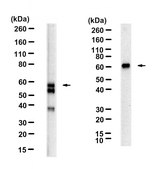 Anti-CA9 Antibody, clone 1B6 ZooMAb® Rabbit Monoclonal recombinant, expressed in HEK 293 cells