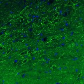Monoclonal Anti-GAD1 antibody produced in mouse Prestige Antibodies® Powered by Atlas Antibodies, clone CL2911, purified immunoglobulin, buffered aqueous glycerol solution