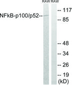 Anti-NF-κB p100 antibody produced in rabbit affinity isolated antibody