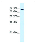 Anti-RHOT1 antibody produced in rabbit affinity isolated antibody