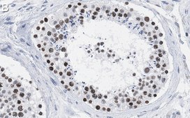 Anti-SUZ12 Antibody, clone 2E2 ZooMAb® Rabbit Monoclonal recombinant, expressed in HEK 293 cells