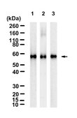 Anti-hCE-1/CES1 Antibody, clone 1D4 ZooMAb® Rabbit Monoclonal recombinant, expressed in HEK 293 cells