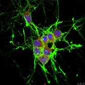 Anti-Protein Gene Product 9.5 Antibody from rabbit, purified by affinity chromatography