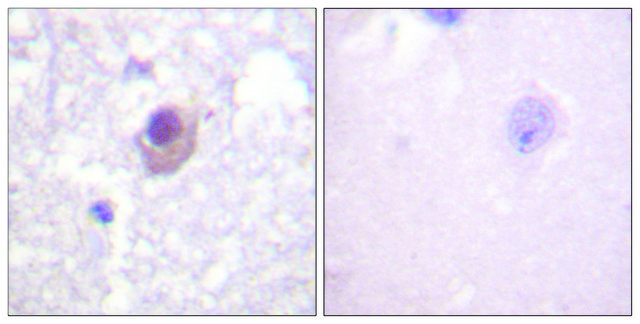 Anti-SGK antibody produced in rabbit affinity isolated antibody