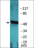 抗 磷酸化 hnRNP K (pSer 284 ) 兔抗 affinity isolated antibody