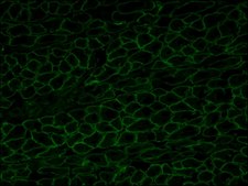 Anti-Dystrophin antibody, Mouse monoclonal clone MANDYS8, purified from hybridoma cell culture