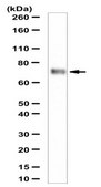 Anti-Serpinf2 Antibody from rabbit, purified by affinity chromatography