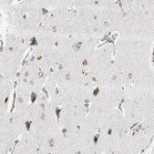 Anti-PSMB4 antibody produced in rabbit Prestige Antibodies® Powered by Atlas Antibodies, affinity isolated antibody, buffered aqueous glycerol solution