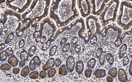 Anti-Gab1 Antibody, clone 4B20, ZooMAb® Rabbit Monoclonal recombinant, expressed in HEK 293 cells