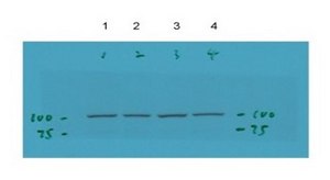 Anti-TRPC6 antibody produced in rabbit affinity isolated antibody