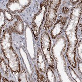 Anti-MGLL antibody produced in rabbit Prestige Antibodies® Powered by Atlas Antibodies, affinity isolated antibody, buffered aqueous glycerol solution