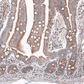 Monoclonal Anti--G6PC antibody produced in mouse Prestige Antibodies® Powered by Atlas Antibodies, clone CL5818, purified immunoglobulin, buffered aqueous glycerol solution