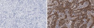 Anti-Integrin pan-αV Antibody, clone EM01309 , ZooMAb® Rabbit Monoclonal recombinant, expressed in HEK 293 cells
