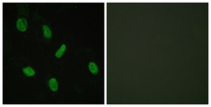 Anti-Androgen Receptor, N-Terminal antibody produced in rabbit affinity isolated antibody