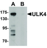 Anti-ULK4 antibody produced in rabbit affinity isolated antibody