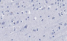Anti-α-synuclein Antibody, clone 1D22 ZooMAb® Rabbit Monoclonal recombinant, expressed in HEK 293 cells