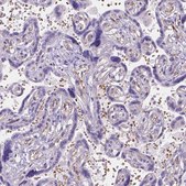 Anti-SLC40A1 antibody produced in rabbit Prestige Antibodies® Powered by Atlas Antibodies, affinity isolated antibody, buffered aqueous glycerol solution