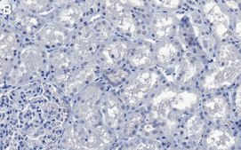 Anti-GSK3α Antibody, clone 2J11 ZooMAb® Rabbit Monoclonal recombinant, expressed in HEK 293 cells