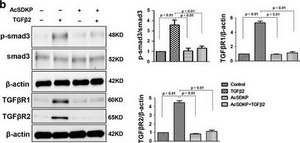 抗-TGF β 受体I 兔抗 affinity isolated antibody