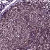 Anti-GOT1 antibody produced in rabbit Prestige Antibodies® Powered by Atlas Antibodies, affinity isolated antibody