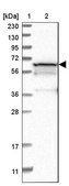 Anti-PGM1 antibody produced in rabbit Prestige Antibodies® Powered by Atlas Antibodies, affinity isolated antibody, buffered aqueous glycerol solution, Ab2