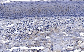 抗-胶原X α1 抗体，克隆1O4 ZooMAb® 兔单克隆 recombinant, expressed in HEK 293 cells