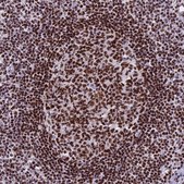 Anti-PARP1 antibody produced in rabbit Prestige Antibodies® Powered by Atlas Antibodies, affinity isolated antibody, buffered aqueous glycerol solution