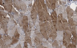 Anti-alpha Actinin 2 Antibody, clone 1E11, ZooMAb® Rabbit Monoclonal recombinant, expressed in HEK 293 cells