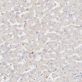 Anti-DNASE1 antibody produced in rabbit Prestige Antibodies® Powered by Atlas Antibodies, affinity isolated antibody, buffered aqueous glycerol solution