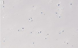 Anti-Collagen Type II Antibody, clone 1K11 ZooMAb® Rabbit Monoclonal recombinant, expressed in HEK 293 cells