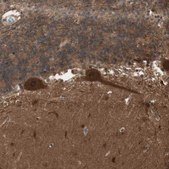 Anti-YWHAB antibody produced in rabbit Prestige Antibodies® Powered by Atlas Antibodies, affinity isolated antibody, buffered aqueous glycerol solution