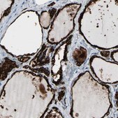 Anti-TPO antibody produced in rabbit Prestige Antibodies® Powered by Atlas Antibodies, affinity isolated antibody, buffered aqueous glycerol solution