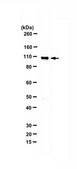 Anti-Histone acetyltransferase KAT2A from rabbit, purified by affinity chromatography