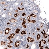 Monoclonal Anti-ACE2 antibody produced in mouse Prestige Antibodies® Powered by Atlas Antibodies, clone CL4013, purified immunoglobulin