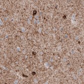 Monoclonal Anti-GAD1 antibody produced in mouse Prestige Antibodies® Powered by Atlas Antibodies, clone CL2911, purified immunoglobulin, buffered aqueous glycerol solution