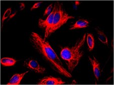 LX-2 Human Hepatic Stellate Cell Line a highly suitable model of human hepatic fibrosis