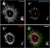 抗磷酸化Drebrin（Ser142）抗体（克隆3C14） clone 3C14, from mouse